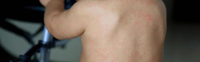 Vrtići i škole su leglo zaraze! Epidemija kulja u ovom evropskom gradu, 160.000 dece u velikoj opasnosti!