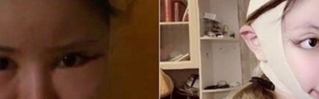 Bogati roditelji finansirali 100 operacija za tri godine