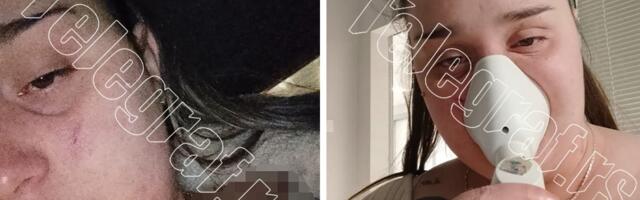 "MOLILA SAM GA DA ME NE UNAKAZI" Devojka preživela pakao u Beogradu, monstrum je sekao nožem gde god je stigao