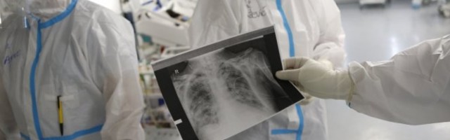 PREMINUO KOVID PACIJENT U PROKUPLJU