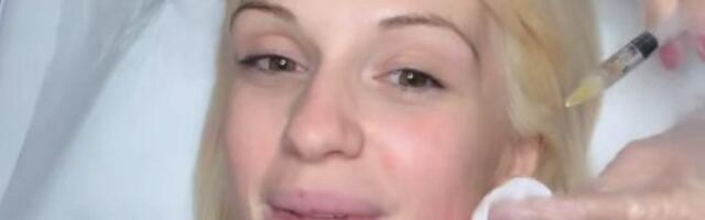 GLUMICA NAKON POROĐAJA OTIŠLA NA REMONT! Anja Mit više ne izgleda isto - ŠOK TRANSFORMACIJA! (GALERIJA)