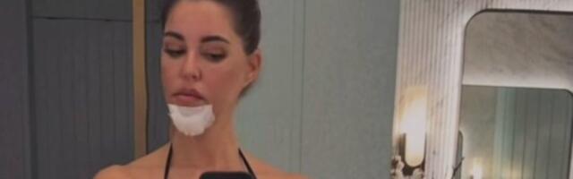 Dijana Dilajn polomila vilicu: Objavila uznemirujuće fotografije nakon nesreće (FOTO)