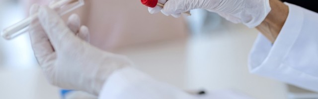 U S. Makedoniji još 862 nova slučaja korone, umrlo 14 ljudi