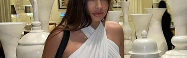 "DEFORMISANA SAM ZAUVEK, KAPAK JE NEPOMIČAN": Ovako je ŠAVIJA izgledala nakon ZVERSKOG PREBIJANJA! NIJE ZA SVAKOGA