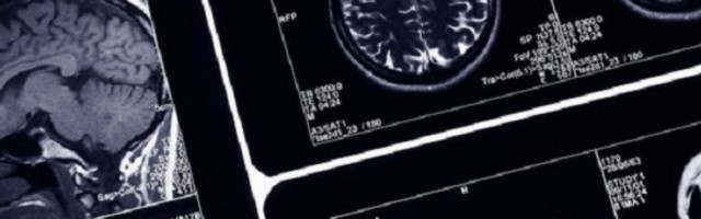 Mozak naših predaka ostao je iznenađujuće majmunski do nedavno