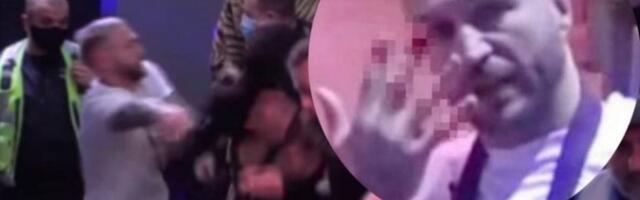 TARA SIMOV POKUŠALA DA ODGRIZE NENADU PRST?! KRV lije iz reperove ruke, obezbeđenje je jedva OBUZDALO! (VIDEO)