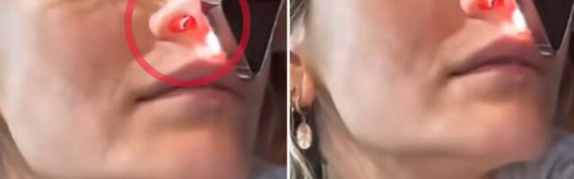 DROGA JOJ UNAKAZILA NOS! Ćerka pokojnog pevača otkrila KAKO DIŠE sa IZBUŠENIM NOZDRVAMA! Snimak POTRESAO sve! (UZNEMIRUJUĆE)