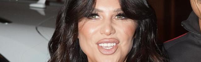 ISPLIVALE SLIKE STANIJE PRE OPERACIJA! Ove će šokirati sve koji misle da je PRIRODNA - RAZLIKA VELIKA KAO KUĆA