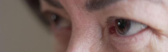 Doktori ćutali o leku koji izaziva ‘rizične’ seksualne nagone kod žena