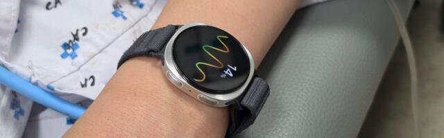 Samsung prvi u svetu predstavio rešenje za predviđanje nesvestice uz pomoć Galaxy Watch uređaja