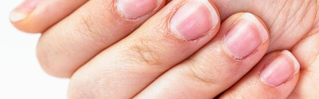 5 namirnica koje bi trebalo da se nađu na vašem meniju ako želite savršen manikir