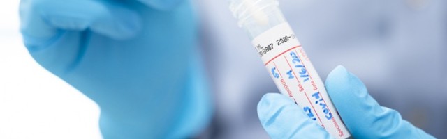 Skoro 2.000 novozaraženih, umrlo 15 pacijenata