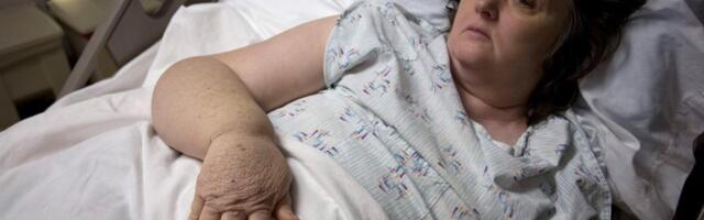 Devet godina su mi govorili da je moj bol "ženski problem": Niko me nije shvatao ozbiljno, a onda je stigla dijagnoza