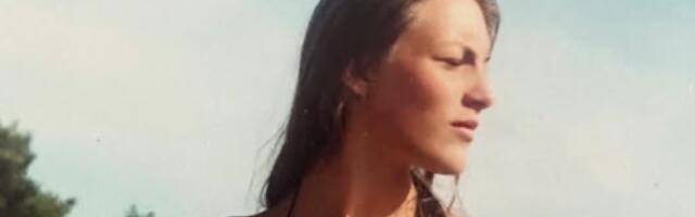 Da li znate ko je na fotografiji? Ovako je izgledala pre estetskih korekcija - Žena je neprepoznatljiva!