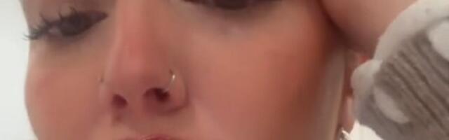 Za punije usne platila 460 EVRA, pa prošla pakao! Nije 2 nedelje izlazila iz kuće