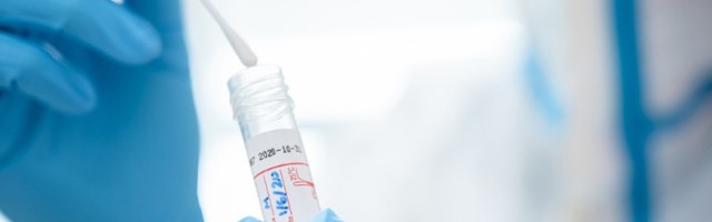 Više od 200 novozaraženih, preminuo jedan pacijent