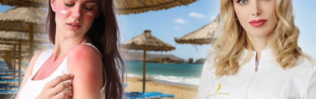 DA LI KISELO MLEKO POMAŽE KOD OPEKOTINA OD SUNCA: Dr Vojvodić objasnila kad možete da koristite prirodne preparate, a kad morate kod lekara!