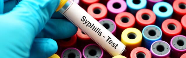 Da li je sifilis zaista stigao iz Amerike? Naučnici imaju nove dokaze