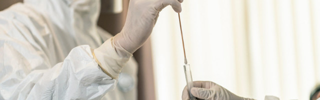 "TESTOVI NEGATIVNI, SNIMAK PLUĆA POKAZUJE VIRUS" Šta raditi u ovim slučajevima?