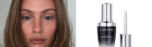 6 koncentrata za lice koji ciljaju konkretne probleme kože