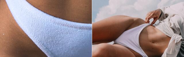 Akne na preponama – kako se leče i kada treba otići dermatologu?