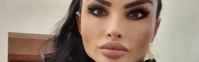 Unakazila mi je sestru vampirskim tretmanom - ljudi o užasima koji su se dešavali u salonu nadrilekarke Olgice Markanović
