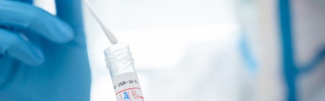 Broj novozaraženih u Novom Sadu - utrostručen