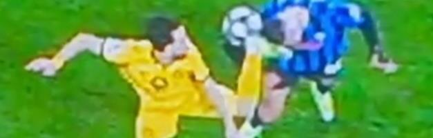 NIKOLA DOBIO STRAVIČAN UDARAC KOPAČKOM U GLAVU! Krstović objavio fotografije iz bolnice - pogledajte kako izgleda! Ostaće gadni ožiljci! (FOTO, VIDEO)