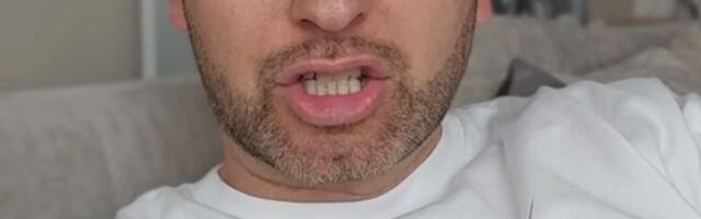 "Raspadaju mi se stopala!" Srpski influenser slikom ostavio sve bez teksta: "Šta je ovo i kad će stati?"