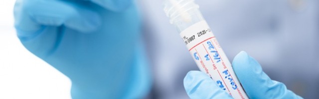 Stanje po gradovima: U Beogradu i dalje najteže