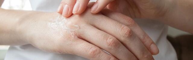 Spas za ispucale ruke! Uz 1 jeftin sastojak iz kuhinje koža će vam biti mekana kao SVILA