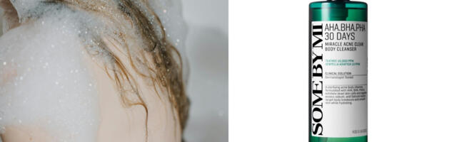 Akne na leđima tokom zime nisu retkost – evo kako da ih rešite