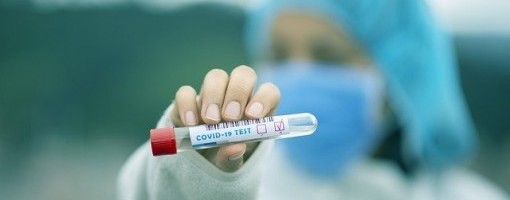 Novih 990 zaraženih i 24 smrtna slučaja u Severnoj Makedoniji