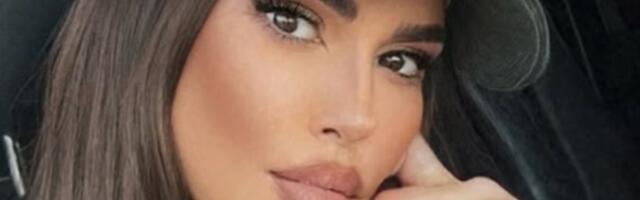 Dijana Diline imala nezgodu na skuteru u punoj blizini u Dubaiju: "Polomila sam vilicu, ne mogu da pričam" (FOTO)