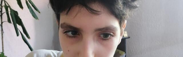 Dušan ima tumor na mozgu, zbog kojeg ne vidi, ne hoda…