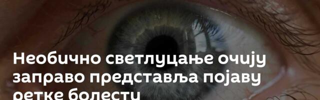 Необично светлуцање очију заправо представља појаву ретке болести