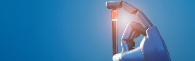 Revolucionarni preokret: Veštačka inteligencija tokom samo jedne noći prepoznaje rizik od preko 100 bolesti