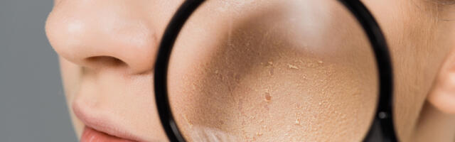 Imate vidljive pore na licu? Imamo rešenje za vas!