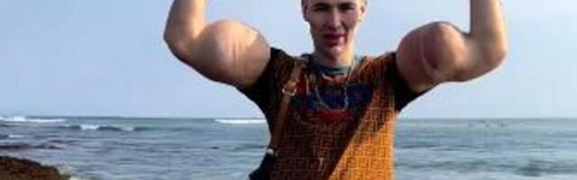 "RUSKI POPAJ" BI MOGAO DA OSTANE BEZ OBE RUKE! Ubrizgavao PETROLEJ KAKO BI IMAO OGROMNE BICEPSE, a sad... (FOTO)