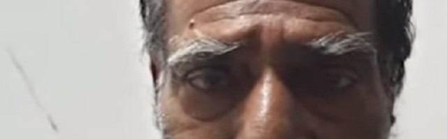 U početku je bila samo kvrga, a kada više nije mogao da je krije, hirurzi su se ZALEDILI! (VIDEO)