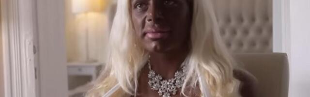 Sate provode u solariju kako bi imale tamniji ten: To nije najgore što rade, nakon sunčanja ubrizgavanju i injekcije "Postalo mi je opsesija"