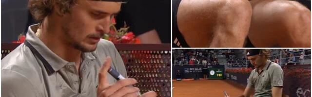 ZVEREV GODINAMA SKRIVAO NEIZLEČIVU BOLSET! Ismevali su ga, krio se u toaletu da primi terapiju, a danas je šampion i inspiracija milionima! (VIDEO)