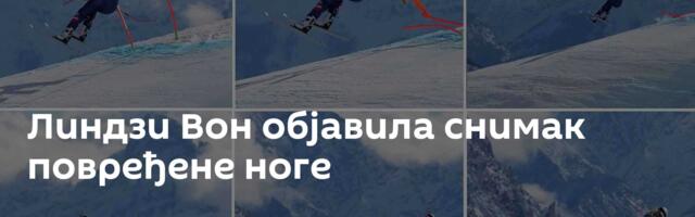 Линдзи Вон објавила снимак повређене ноге
