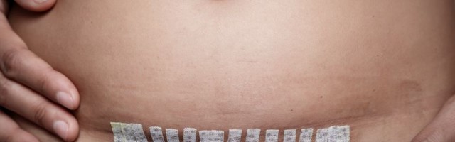 CARSKI REZ: 8 svakodnevnih stvari koje neće moći da radite nakon porođaja