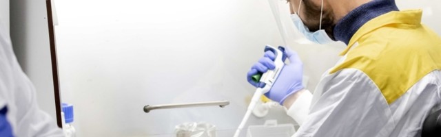 Evo koliko virus korone može da preživi na vašoj koži!