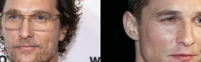 Da li je Metju Mekonahi zaista uspeo da izleči ćelavost?