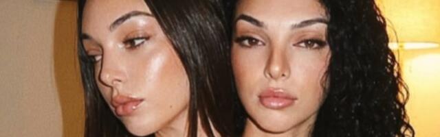 Istina o viralnim „spojenim bliznakinjama“ koje su osvojile Instagram