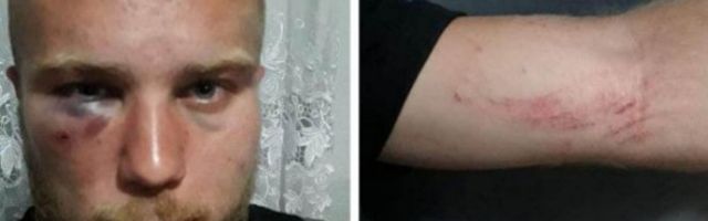 PRETUČEN MLADIĆ U BIJELOM POLJU! Petorica Petru preprečila put, psovali mu srpsku majku i iživljavali se na njemu!
