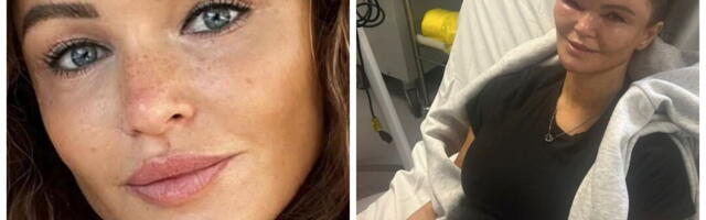 Počeli su da joj se javljaju blagi otoci pa umalo nije oslepela: Ignorisala je simptome dok nije saznala za retku genetsku bolest