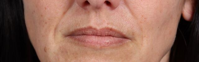 Nisu samo godine krive: Ova stvar pravi bore i kad koristite najbolju kozmetiku